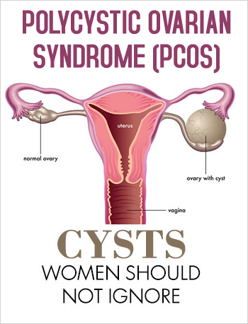 PCOS / PCOD